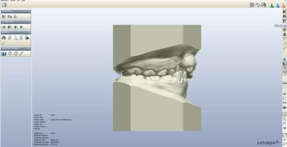 4 Material e Métodos 73 Figura 18: Imagem virtual obtida de modelo de gesso escaneado no presente estudo.