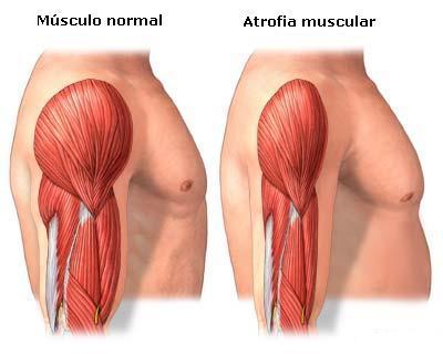 TÔNUS MUSCULAR Em condições normais há sempre fibras musculares