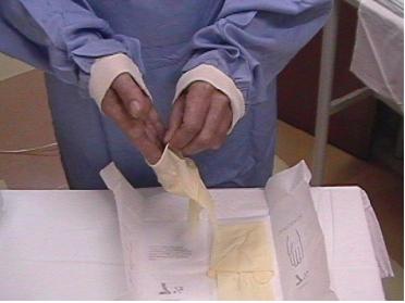 Secagem das mãos As mãos e braços devem ser secas com toalha estéril, que pode ser alcançada ou tirada do pacote cirúrgico. Pegar com uma mão por uma das pontas, longe do corpo e desdobrar.