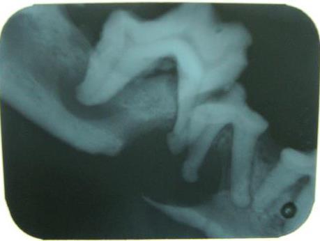 4 Figura 3: Radiografia intra-oral do foco de fratura no ramo mandibular A cadela foi submetida a mandibulectomia parcial direita (figura 4) e como pós operatório recomendou-se dieta pastosa,