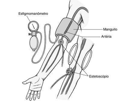reduzida corresponde à pressão arterial sistólica