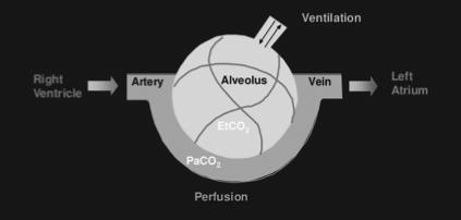 a ventilação?