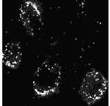 ( controle) os vírus (pontos brancos) chegam normalmente ao núcleo das célula. B.