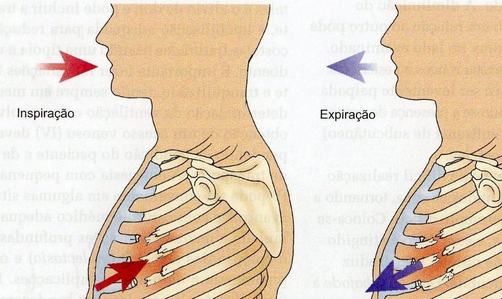 TÓRAX INSTÁVEL Fratura de dois ou mais arcos costais consecutivos, em mais de um local, ocasionando descontinuidade da área acometida respiração paradoxal Repercussão: contusão pulmonar (sangramento