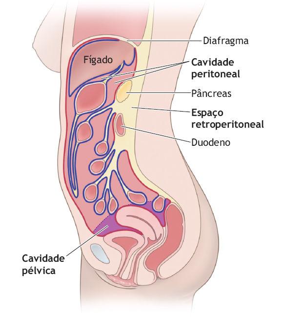 vascular, formação de edema após reperfusão do músculo isquemiado Sinais 5Ps Dor (Pain) Parestesia