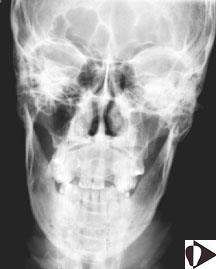 IMAGENS ADQUIRIDAS Radiografia em