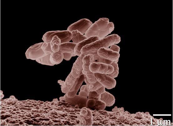 VI) Contextualização microbiológica Figura 5 Bactéria E.
