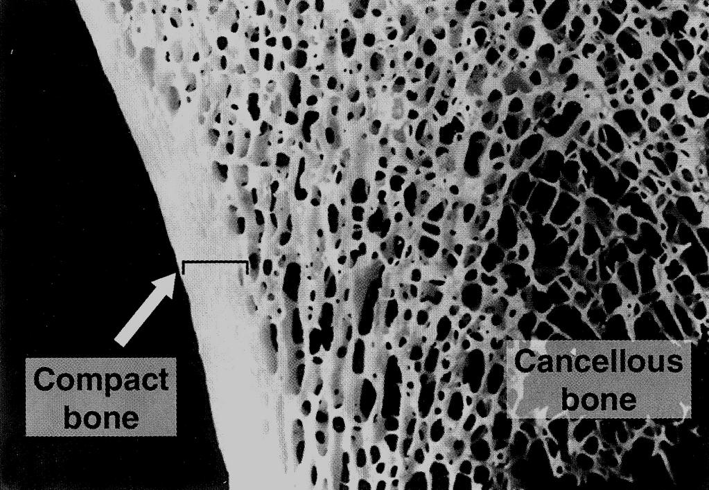 Observação macroscópica Osso compacto (sem cavidades