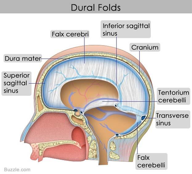 Localizações típicas: Supratentorial - Mais freq convexidade cerebral (25%) - sagital e parasagital fissura sylviana asa do esfenoide (18%) tubérculo e diafragma selar goteira olfatoria