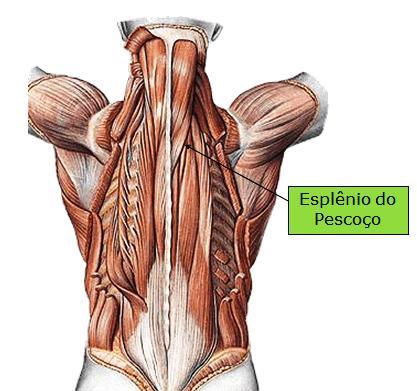43 O músculo esplênio do pescoço, com morfologia plana e quadrangular, situa-se abaixo da musculatura do serrátil póstero-superior, com origem no ligamento nucal e processos espinhosos de C3 a T3,