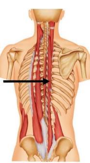 46 Figura 31: Interespinhais torácicos e lombares Fonte: Wecker; Soares; Nemos, 2001 A musculatura intertransversal cervical tem origem no processo espinhoso da vértebra supra adjacente, inserção nos