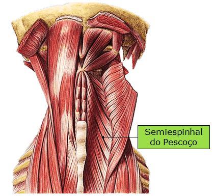 50 Figura 36: Semiespinhal do pescoço Fonte: Wecker; Soares; Nemos, 2001 Músculo plano intercedido por um tendão