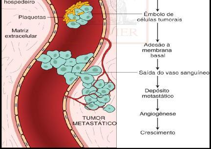 ese deslocam para outras regiões do corpo onde crescem como