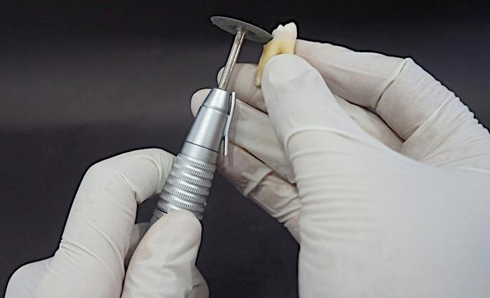 Para padronização da amostra, todos os dentes deveriam ter o comprimento de 16 mm medidos por meio de um