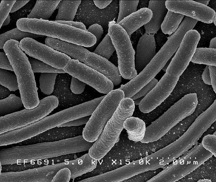 Escherichia coli ao microscópio eletrônico.