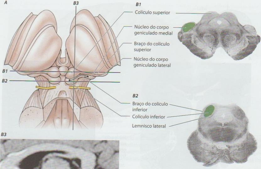 O colículo inferior também é subdividido em núcleos central, externo e dorsal.