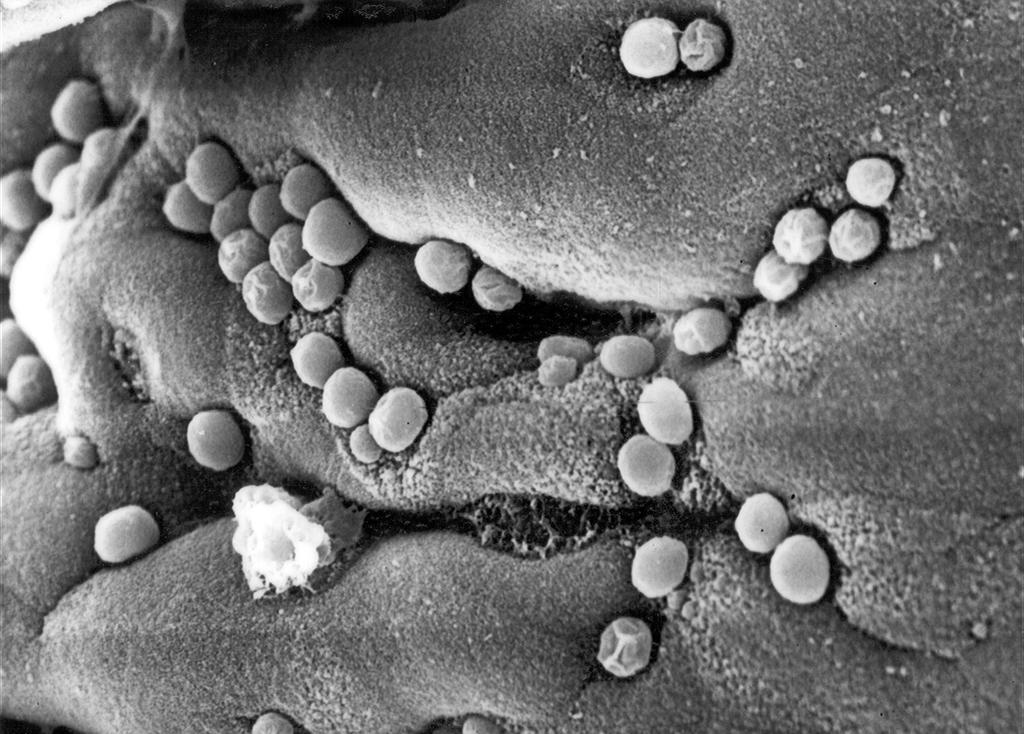 Criptosporidiose Agente etiológico Cryptosporidium parvum (Tyzzer, 1907) Taxonomia: Filo: