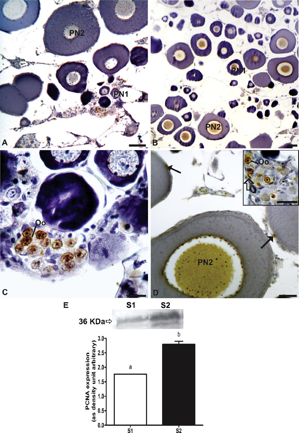 58 R.G. Thomé et al. / Tissue and Cell 44 (2012) 54 62 Fig. 3. Immunohistochemistry for PCNA in ovarian sections of the P.