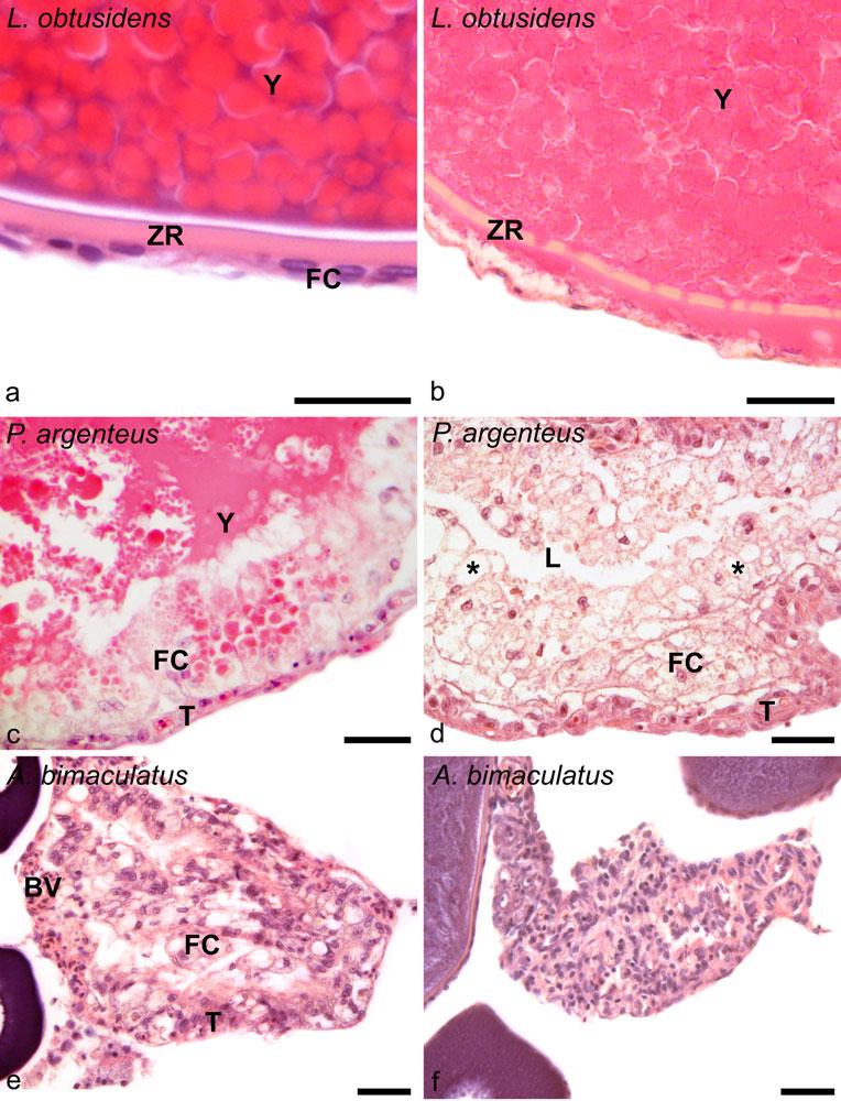 470 Cell Tissue Res (2012) 347:467 478 Fig. 1 Main events of ovarian follicular atresia in three fish species: Leporinus obtusidens, Prochilodus argenteus, Astyanax bimaculatus.