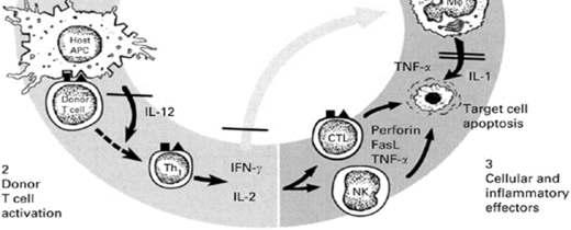 IFN-gama