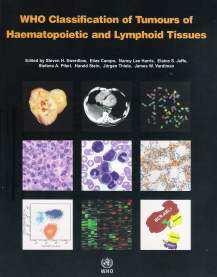 Neoplasias histiocíticas (1%) Fagócitos mononucleares Histiócitos são definidos como células com alto conteúdo de enzimas lisosomais, capacidade fagocítica, derivados dos monócitos medulares, que por