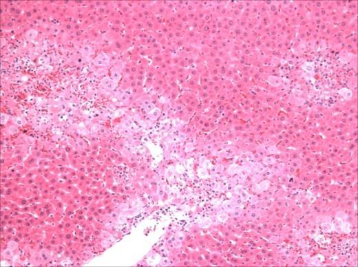 No tecido hepático de animais dos grupos CO (6-A) e Mel (6-B) é possível observar um parênquima hepático normal, com cordões de hepatócitos bem definidos e núcleos celulares