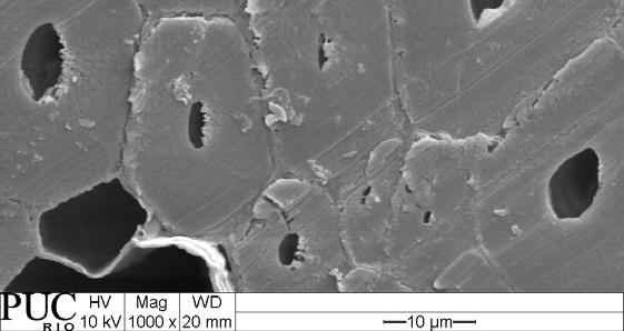 as microfibrilas da fibra