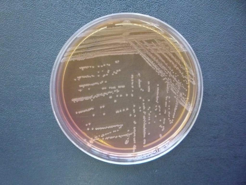 S.aureus V.cholerae E.coli Salmonella sp.