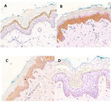 3 Casuística e Métodos 24 Figura 8 - Imuno-histoquímica de fragmentos de pele normal obtidos de biópsias: controles positivos