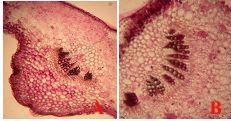 As brácteas desta espécie também apresentam epiderme simples, apresentando face adaxial mais espessa, com cutícula e epiderme papilada.