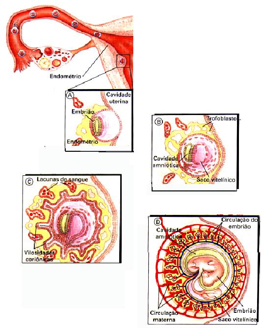 I. Blastocisto (antes de nidar). II. Trofoblasto inicia rápidas mitoses e erode o endométrio. III. Endométrio cresce por cima do embrião. IV.