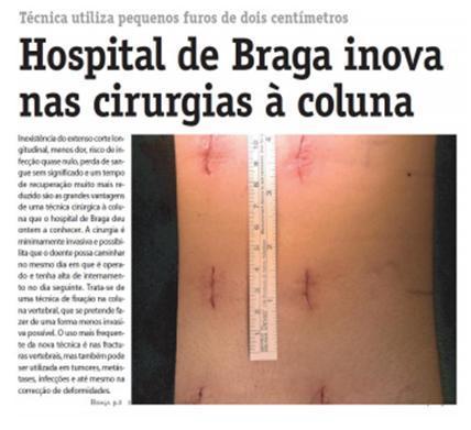 Qualidade o HB aposta na diferenciação da prática clínica como factor de desenvolvimento estratégico O Hospital de Braga utiliza desde Novembro de 2010 uma técnica inovadora, pouco invasiva, para
