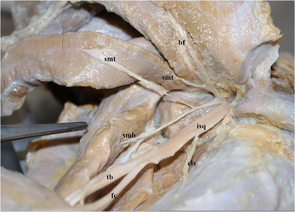 Figura 3 - Fotografia da face dorsal da coxa direita de Procyon cancrívorus, visibilizando o nervo isquiático (isq) e seus ramos para os músculos bíceps