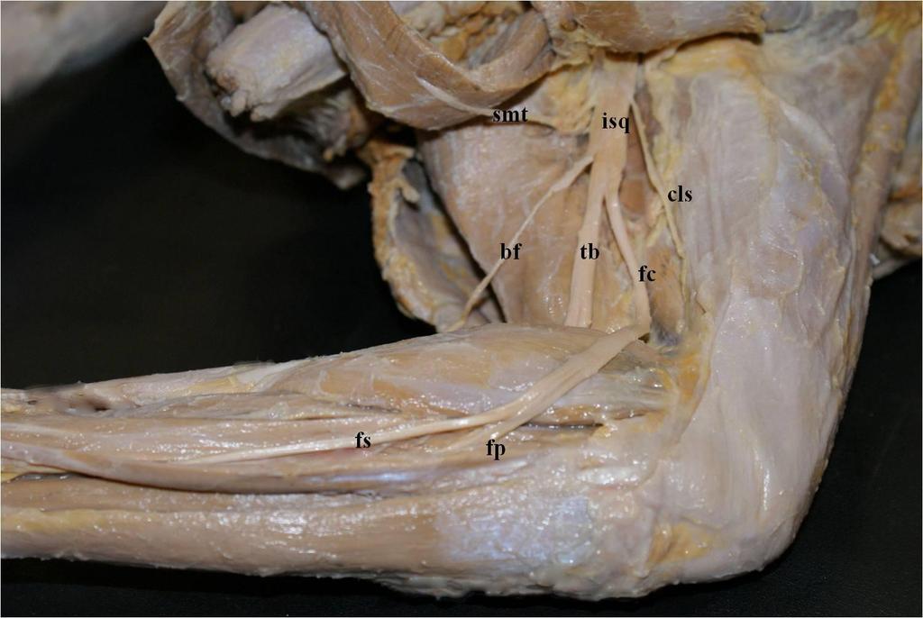 22 Figura 4 - Fotografia da face dorsal do membro pélvico direito de Procyon cancrívorus, observando os músculos semitendíneo e bíceps femoral rebatidos, o nervo isquiático (isq) bifurcando-se em