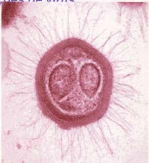 Mimivirus, um vírus gigante de amebas aquáticas Visíveis a MO (800 nm) Genoma DNA 1,2 milhões de bases (codifica > 900 ptns) Apresentam RNA Outros vírus gigantes foram