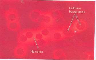 MEIO DE CULTURA DIFERENCIAL O meio ágar sangue contém células vermelhas do sangue.
