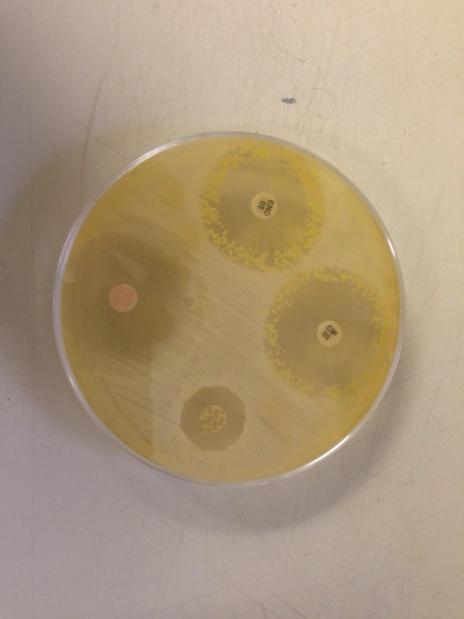 Figura 24 - Resultado do antibiograma após incubação de 24 horas. Fonte: Arquivo Pessoal/Rafael Marques 3.9.