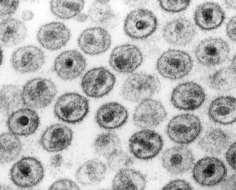 Família Retroviridae Subfamília Oncovirinae Gênero Oncovirus HTLV-I (leucemias e linfomas de cels T, doenças neurodegenerativas)