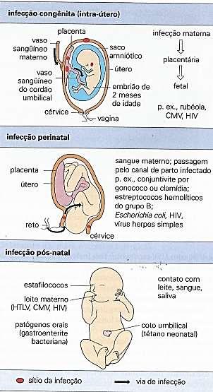Placenta Passagem pelo canal de parto Contato com leite, sangue, saliva HBV Zika