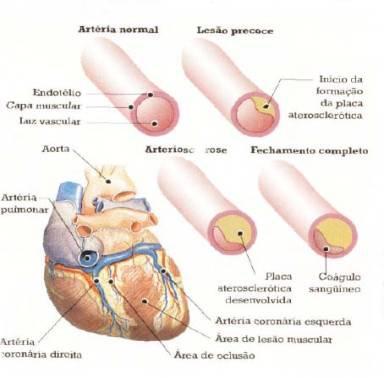 Risco Cirúrgico Paciente Cardiopatas As situações mais freqüentes associadas a episódios isquêmicos no