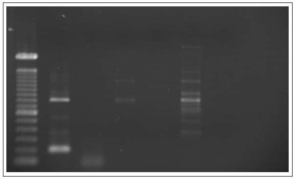 1 2 3 4 5 6 7 190 pb FIGURA 8 Resultado da eletroforese do par de iniciador LCL1/LCL3 após a otimização do protocolo de PCR (30 ciclos, 60 C). 1- marcador de 100 pb; 2- DNA de L.