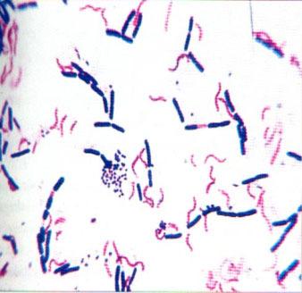 Colorações em bacteriologia Colorações diferenciais Utiliza-se dois ou mais corantes