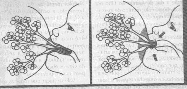 Etapas da sucção 1. Compressão do mamilo pela contração dos músc. Faciais ( princ. Labiais) 2. Tanto a língua, como a mandíbula se elevam 3.