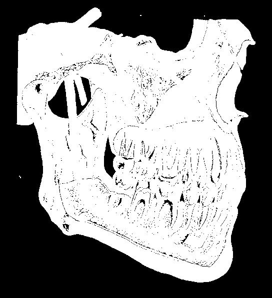 (posterior, médio e anterior) RAMO