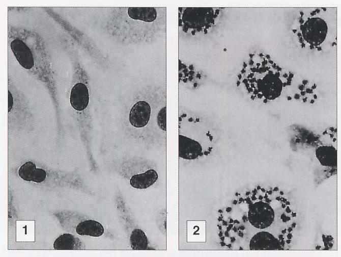 Macrófagos ativados por IFN-gama eliminam Leishmania