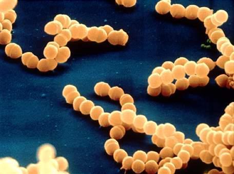 causa doença: pele Streptococcus pneumoniae - preferencial: