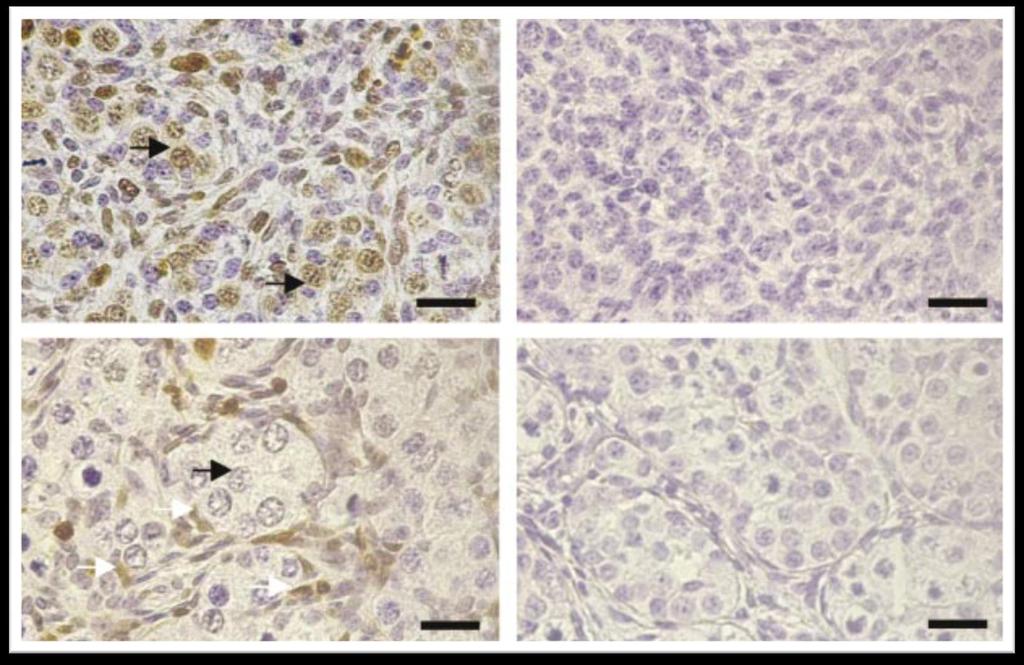 Resultados e Discussão (a) (b) oogônia (c) célula somática (d) Imunohistoquímica Proliferação predominantemente para