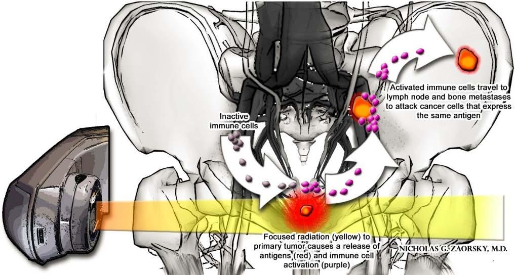 Efeito Abscopal AB = away from e SCOPUS = target