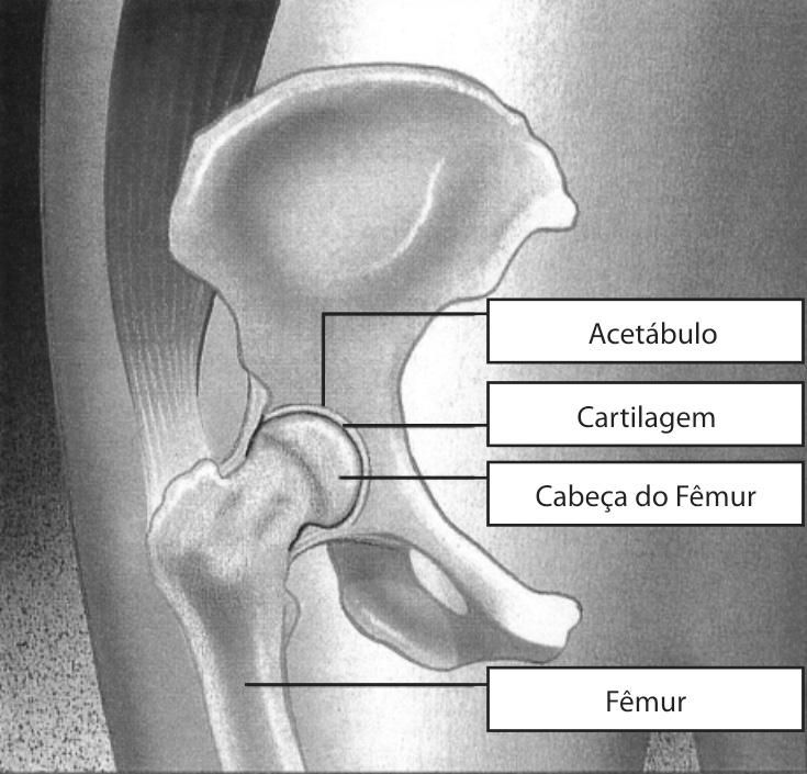 Artrose (desgaste do quadril) O quadril é a articulação que liga o osso da coxa (fêmur) ao osso da bacia (pélvis), permitindo os movimentos dos membros inferiores.