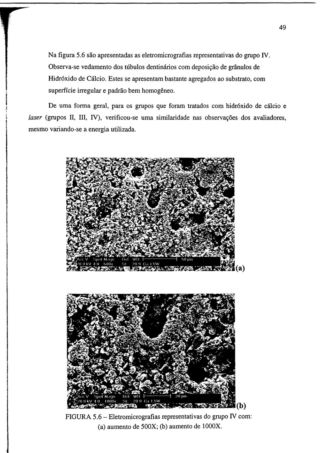 49 Na figura 5.6 são apresentadas as eletromicrografias representativas do grupo IV. Observa-se vedamento dos túbulos dentinários com deposição de grânulos de Hidróxido de Cálcio.